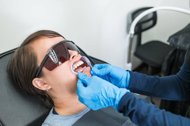 Best Chipped Tooth Repair Near Me  in St James, MD