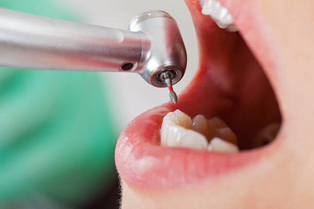 Best Emergency Dentist No Insurance  in St James, MD
